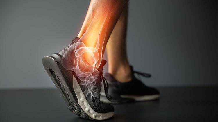 Aşil tendonu nedir, nerededir, ismini nereden alır? Aşil tendonu ağrısı nasıl geçer?