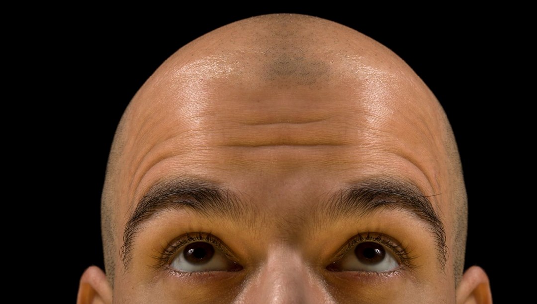 Ülkelerin saç haritası çıkarıldı: En çok kel Çekya’da