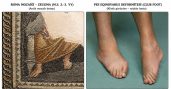 1800 yıllık Zeugma mozaiğinde tıbbi iz!